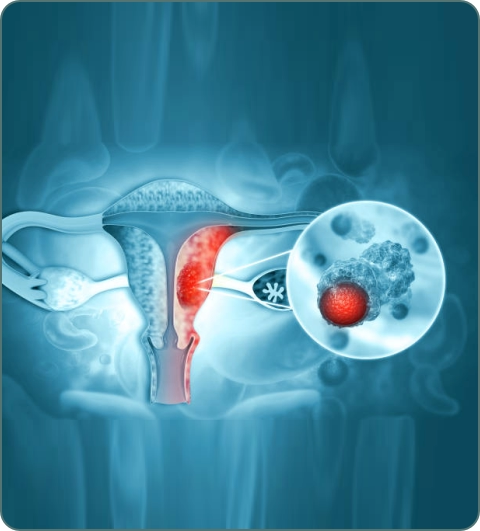 Radiation oncology and cancer treatment illustration